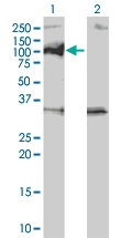 H00008493-M01 - Protein phosphatase 1D / PPM1D
