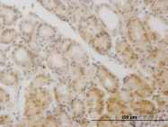 H00008521-M05 - GCM1 / GCMA