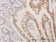 H00008537-M03 - BCAS1 / NABC1