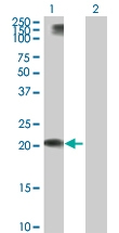 H00008542-B01P - Apolipoprotein L1 / APOL1
