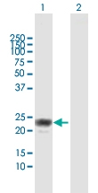 H00008542-D01 - Apolipoprotein L1 / APOL1