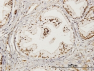 H00008543-M02 - LMO4