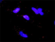 H00008550-D01P - MAPKAP Kinase-5
