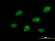 H00008555-B01P - CDC14B