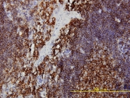H00008575-M01 - PRKRA / PACT