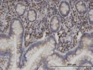 H00008615-M03 - USO1