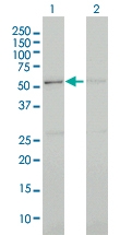 H00008621-M02 - CDK13 / CDC2L5