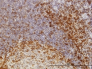 H00008631-M01 - SCAP1 / SKAP55