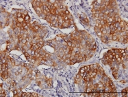 H00008672-M03 - EIF4G3