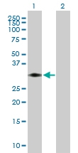 H00008676-B01P - Syntaxin 11 / STX11