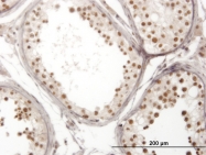 H00008715-M01 - NOL4