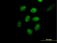 H00008726-B01P - Polycomb protein EED