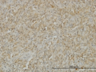 H00008740-M01 - CD258 / LIGHT