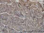 H00008767-M05 - RIPK2