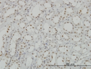 H00008814-M01 - CDKL1