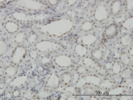 H00008814-M03 - CDKL1