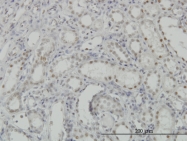 H00008814-M05 - CDKL1
