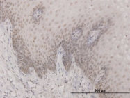 H00008819-M02 - SAP30
