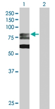 H00008833-D01P - GMP synthetase / GMPS