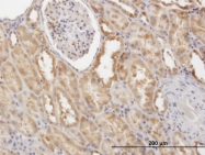 H00008837-M01 - CFLAR / Casper / I-FLICE