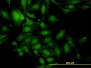 H00008848-M01 - TSC22D1