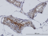 H00008852-M02 - AKAP4