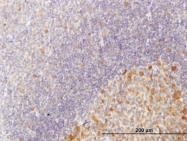 H00008872-B01P - CDC123