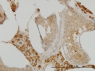 H00008872-M08 - CDC123