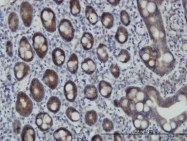 H00008882-M01 - ZNF259