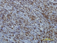 H00008892-M01 - EIF2B2 / EIF2BB