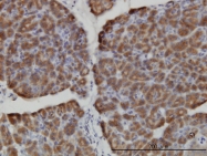 H00008916-M01 - HERC3