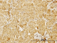 H00008976-M04 - WASL / N-WASP