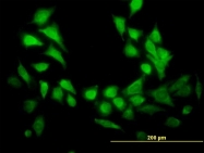 H00008987-B01 - STBD1 / Genethonin-1