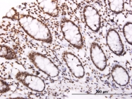 H00009021-M02 - SOCS3 / CIS3