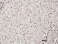 H00009031-M01 - BAZ1B / WSTF