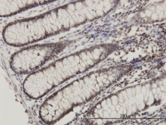 H00009045-M01 - RPL14