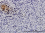 H00009068-M03 - Angiopoietin-3