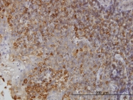 H00009111-M01 - NMI