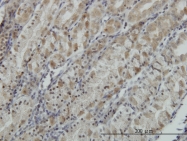 H00009114-M01 - ATP6V0D1