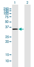 H00009124-B01 - PDLIM1