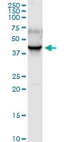 H00009124-D01 - PDLIM1