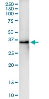 H00009124-D01 - PDLIM1