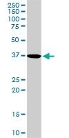 H00009124-D01P - PDLIM1