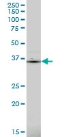 H00009124-M02 - PDLIM1