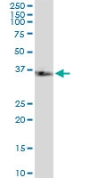 H00009130-A01 - FAM50A