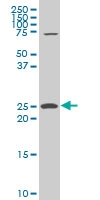 H00009144-A01 - Synaptogyrin-2 / SYNGR2