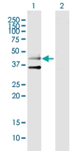 H00009177-B01P - Serotonin receptor 3B (HTR3B)