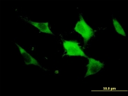 H00009201-M02 - Doublecortin-like kinase 1