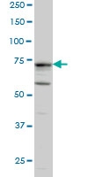 H00009201-M03 - Doublecortin-like kinase 1