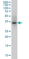 H00009212-M01A - Aurora kinase B